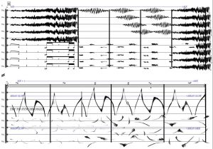 Page from A la Recherche du Temps - Doloroso
